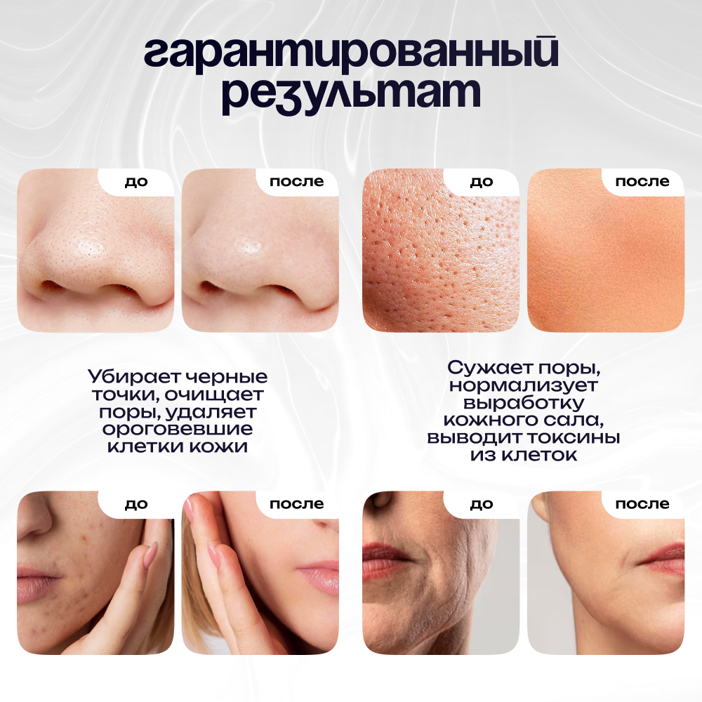 Ультразвуковая чистка лица Doctor Comfort US-3 PRO