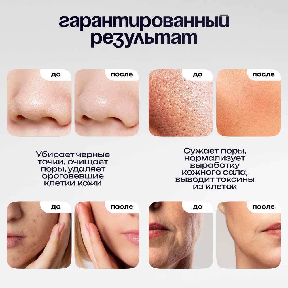 Ультразвуковая чистка лица Doctor Comfort US-9 MAX