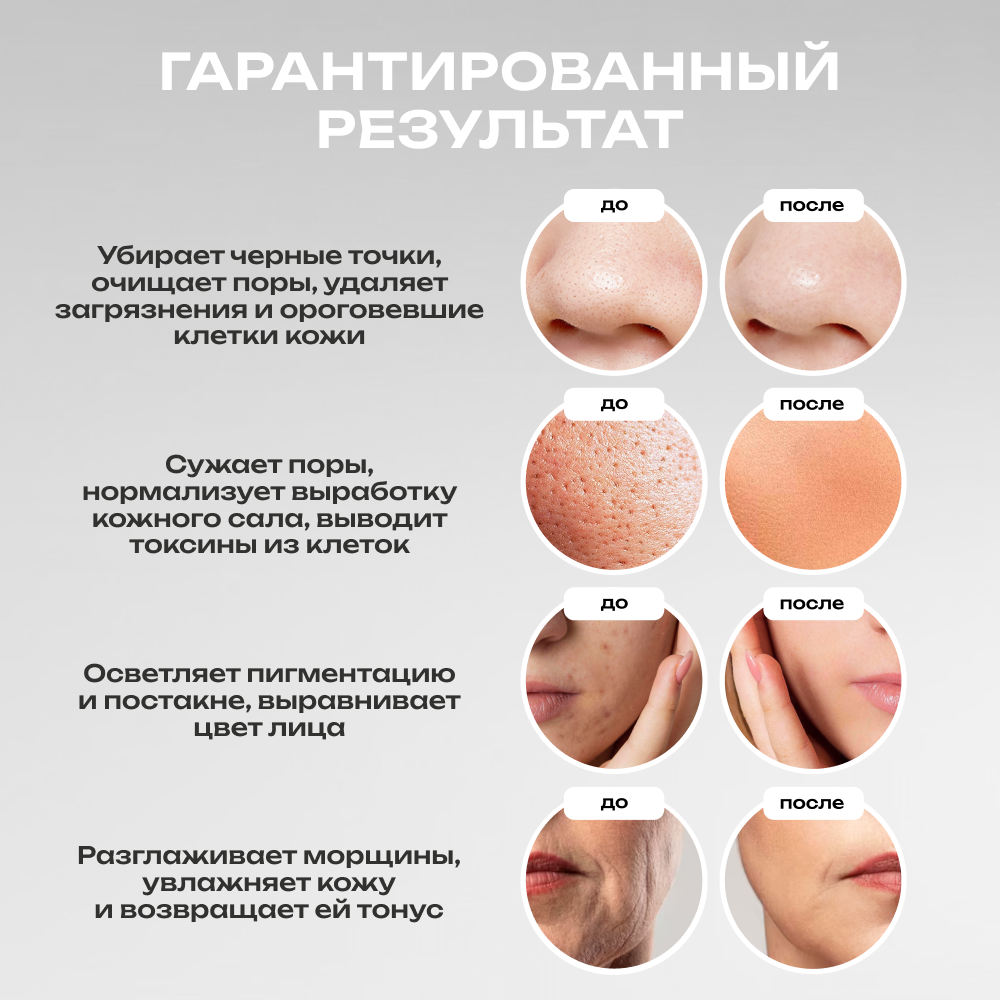 Ультразвуковая чистка лица Doctor Comfort US-2 TRIO